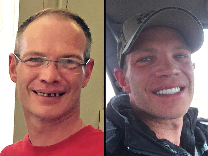 Customer Responded After Noticing This Waiter's Bad Teeth (Photos)