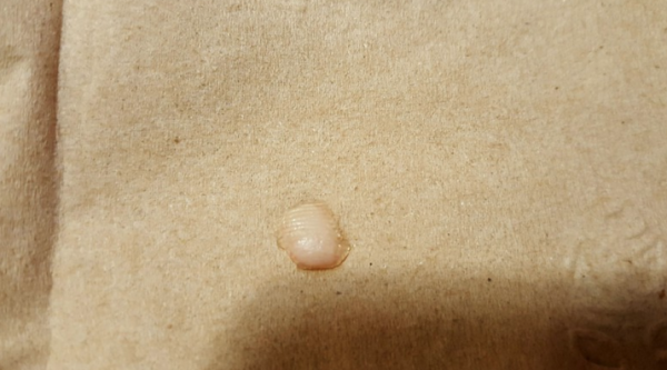 fingertip-found-in-the-salad-paso-robles-applebees