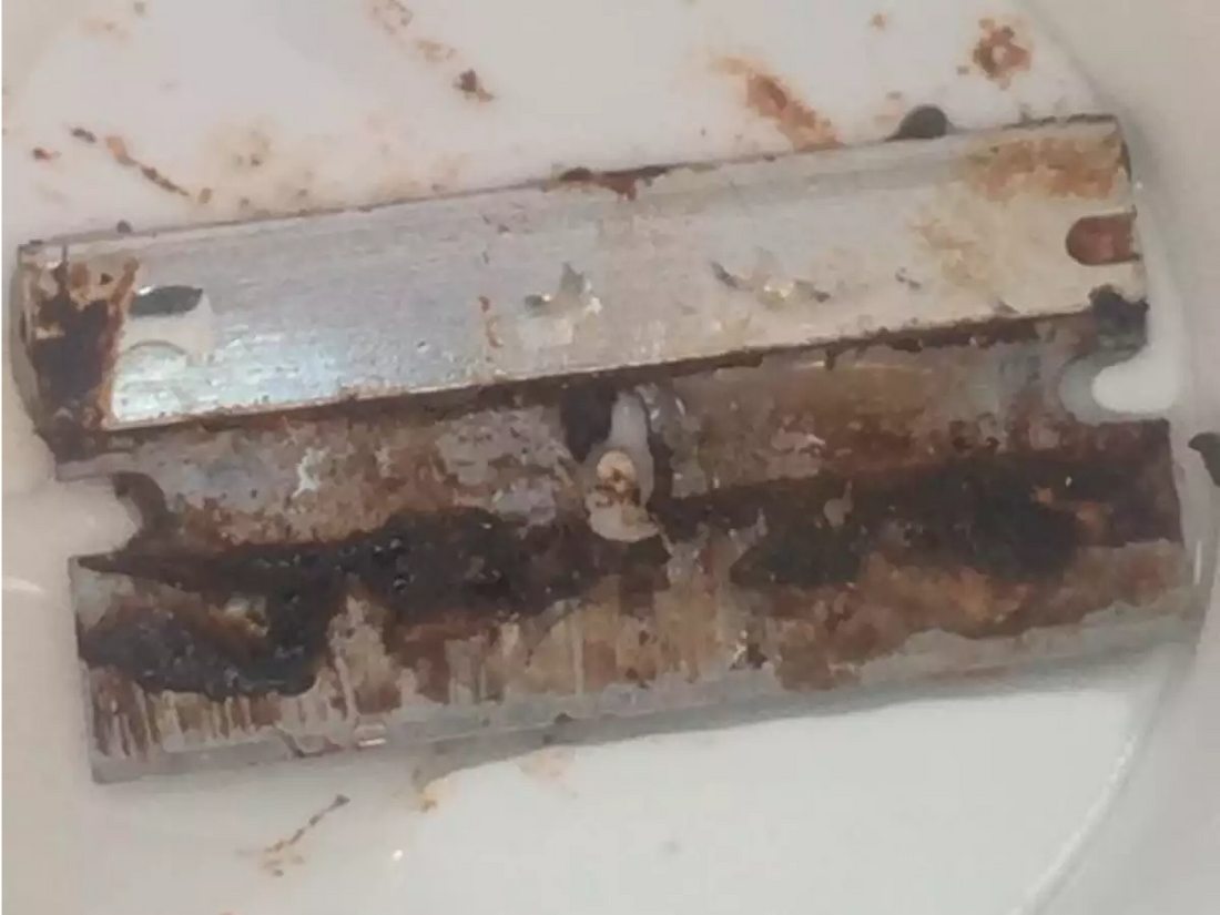 Girl Finds Deadly Razor Blade In Fast-Food Soda